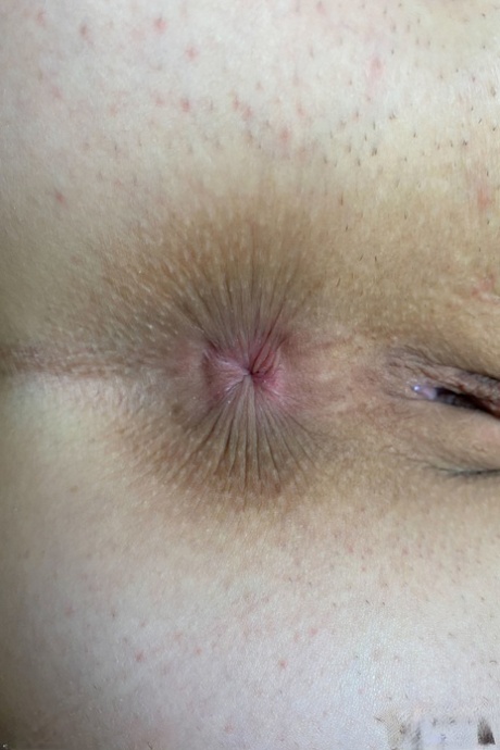 asshole close up naked archive
