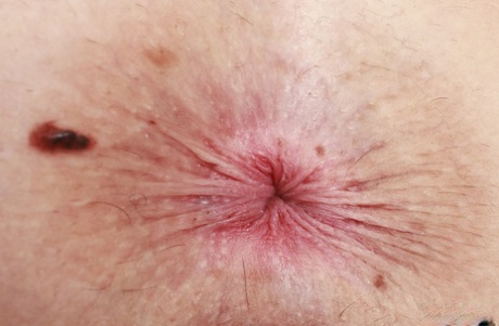 anus lepa porno arhiv