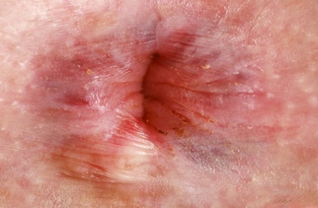 asshole close up free naked pictures