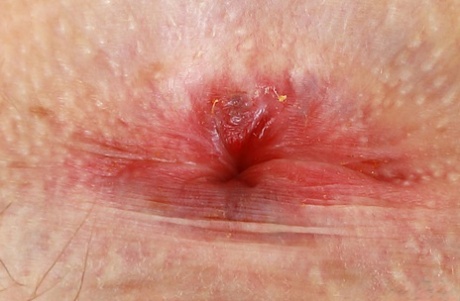 asshole close up hot porn photos