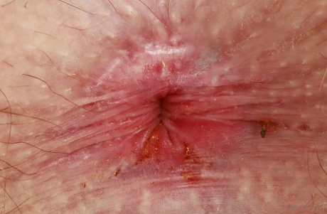 göt deliği yakın çekim sıcak porno resimler
