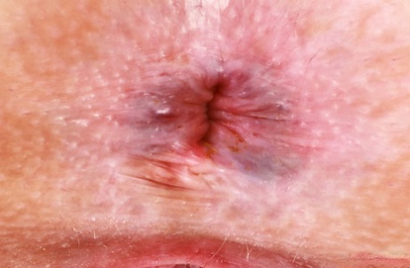 Arschloch Nahaufnahme hd kostenlose bild