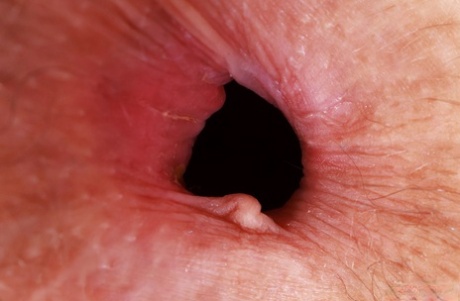 asshole close up sexy nudes photo