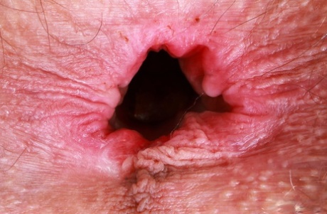 ensam anal top xxx arkiv
