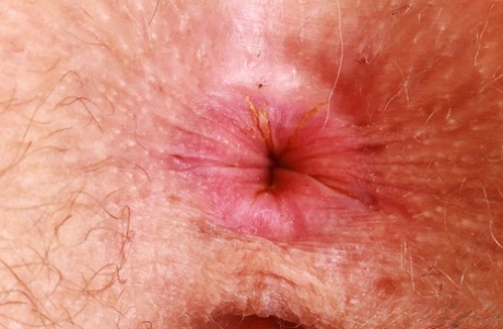 roodharige sproeten naakten erotisch foto