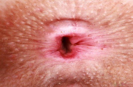 tinejdžerski analni zev umjetnost porno slika